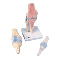 Anatomical Sectional Knee Joint Model