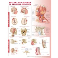 Anatomy and Injuries of the Head & Neck (Poster - Rigid Lamination)