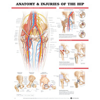 Anatomy and Injuries of the Hip (Poster - Soft Lamination)