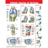 Athletic Injuries of the Knee (Poster - Rigid Lamination)
