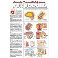 STD - Gonorrhea