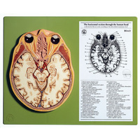 Horizontal Section of the Head