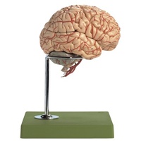 Brain with Arteries and Stand