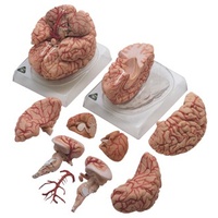 Brain with Arteries