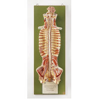 Spinal Cord in Spinal Canal