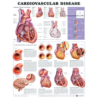 Anatomical Cardiovascular Disease Chart