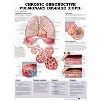 Chronic Obstructive Pulmonary Disease (Poster - Rigid Lamination)
