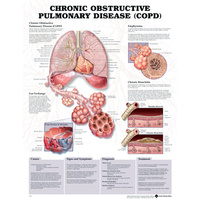 Anatomical Chronic Obstructive Pulmonary Disease Chart