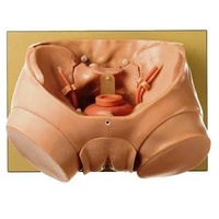 CLA Bladder Phantom For Endoscopy