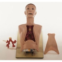 Bronchoscopy Model - Sick Boy With Healthy And Sicky Bronchial Tree
