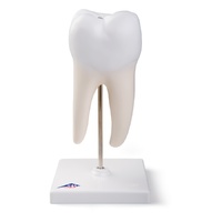 Anatomical Model- Lower Twin-Root Molar showing cavities, 2 part