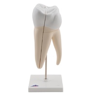 Anatomical Model- Upper Triple-Root Molar, 3 part