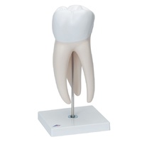 Anatomical Upper Triple Root Molar with Dental Cavities Model 6 part