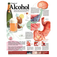 Anatomical Chart- Dangers of Alcohol 