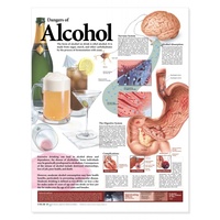 Anatomical Chart- Dangers of Alcohol