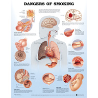 Dangers of Smoking (Poster - Rigid Lamination)