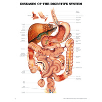 Anatomical Chart- Diseases of the Digestive System