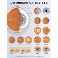 Disorders of the Eye (Poster - Soft Lamination)