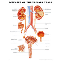 Diseases of the Urinary Tract (Poster - Rigid Lamination)