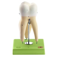First Upper Molar with Three Roots