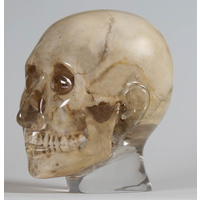X-ray Phantom Head, Transparent
