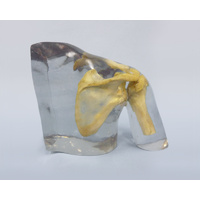 X-ray Phantom Shoulder, Transparent