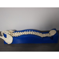  Full Spine Holder - Posterior