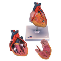 Anatomical Models of Classic Heart with Bypass