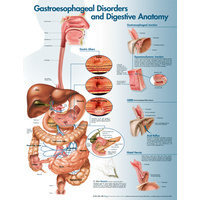 Gastroesophageal Disorders (Poster - Soft Lamination)