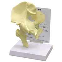 Anatomical Model- Basic Hip
