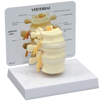 Anatomical Model- Basic Vertebrae