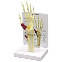 Anatomical Model- Hand/Wrist Carpal Tunnel Syndrome
