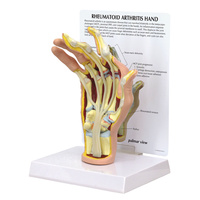 Anatomical Rheumatoid Arthritis Hand Model