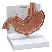 Anatomical Stomach with Ulcers Model