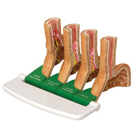 Anatomical Model- Gastroesophageal Reflux Disease (GERD) 