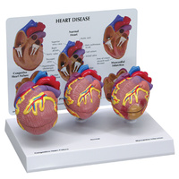 Anatomical Model- Mini Heart Set
