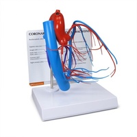 Coronary Arteries and Cardiac Veins – Model