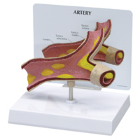Anatomical Model- Artery
