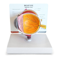 Anatomical Model- Eye