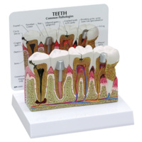 Anatomical Model- Teeth