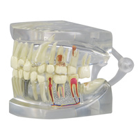 Anatomical Model- Clear Human Jaw with Teeth