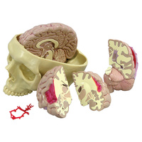 Anatomical Model- Brain