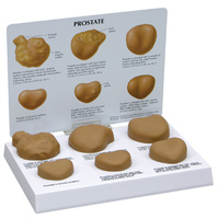 Anatomical Model- Prostate