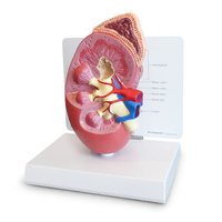 Anatomical Model- Kidney