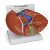Anatomical Model- Liver/Gallbladder with Gallstones