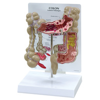 Anatomical Model- Colon
