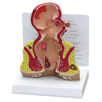 Anatomical Model- Rectum
