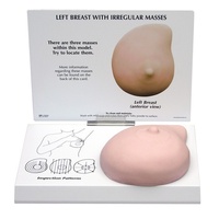 Breast Cancer