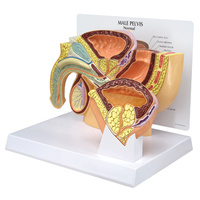 Anatomical Model- Male Pelvis with BPH