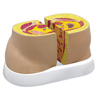 Anatomical Model- Obesity Model